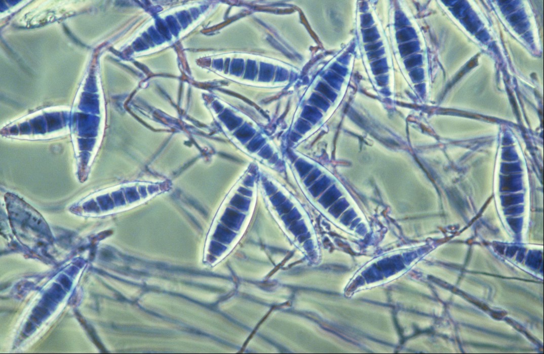 Ringworm microsporum stained purple