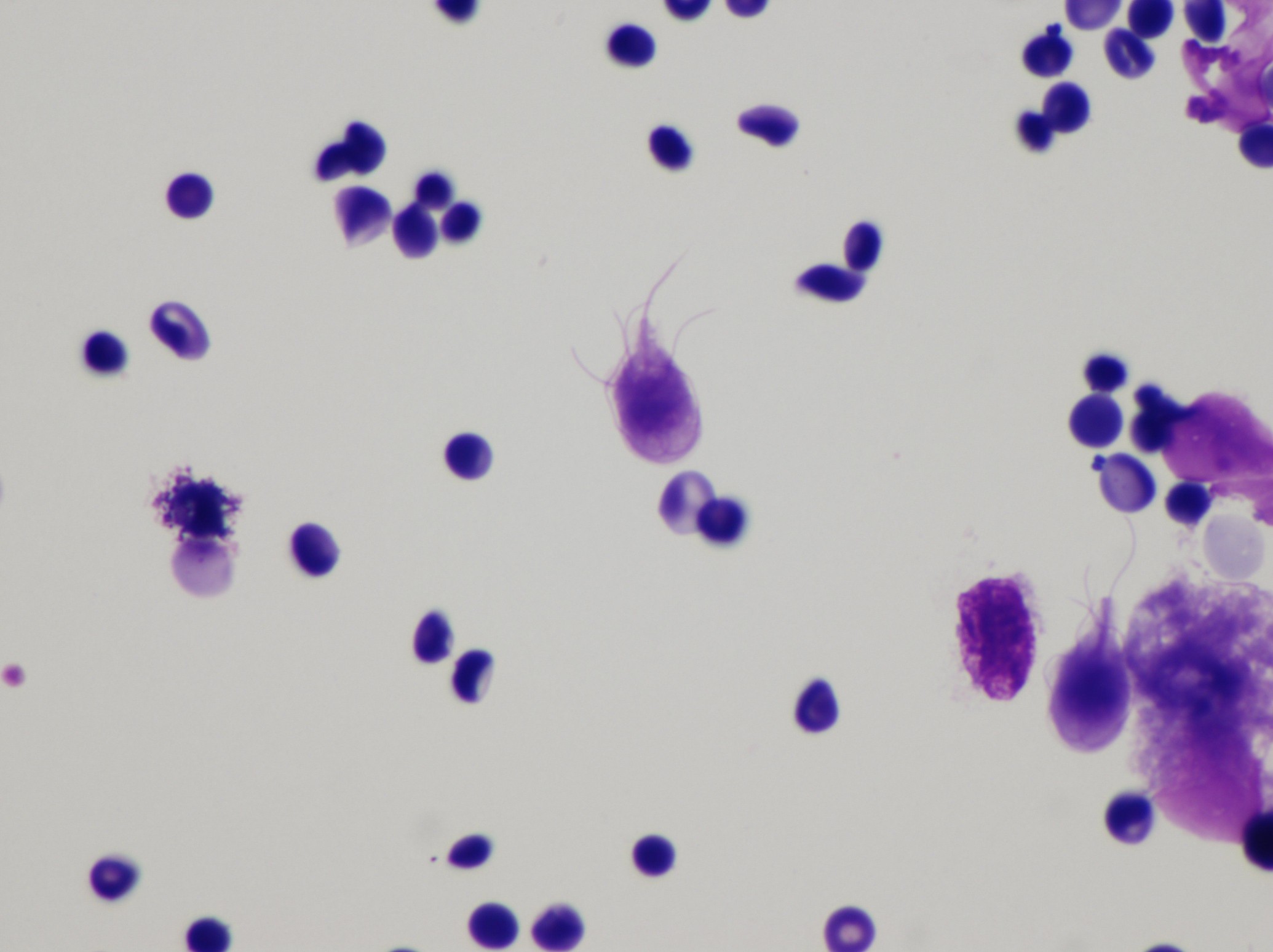 Giardia lamblia