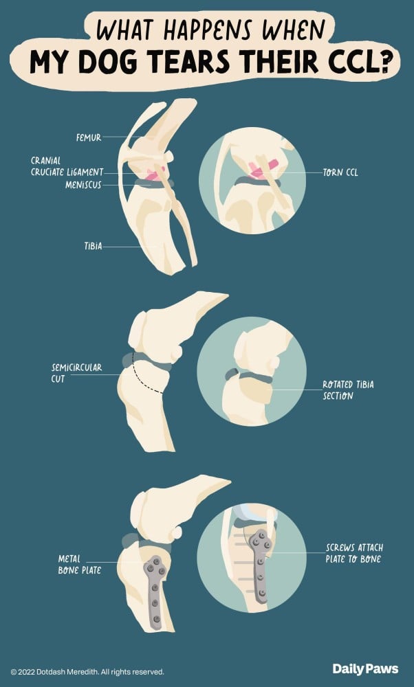 medical illustrations of what a normal and torn CCl looks like along with what it looks like after surgery