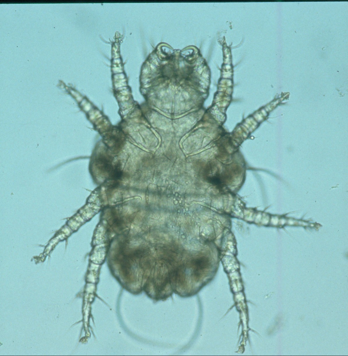 Cheyletiella Mites