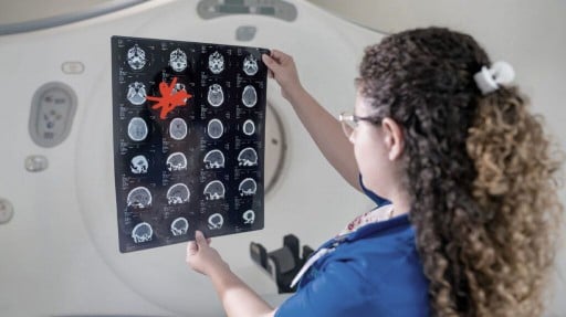 female researcher with long curly hair holding up brain scan
