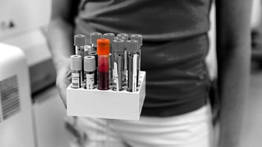 A person holding tubes of blood samples