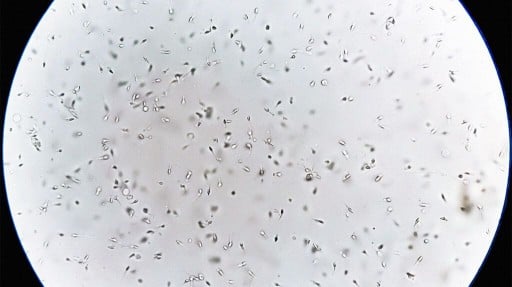 Semen observed under a microscope